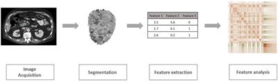 Prognostic Value of Transfer Learning Based Features in Resectable Pancreatic Ductal Adenocarcinoma